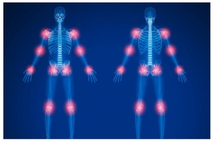 Diputación de Cáceres y FEXAF elaboran una guía sobre el dolor crónico para informar, orientar y apoyar a las personas afectadas
